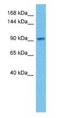 Western Blot: ADAM8 Antibody [NBP3-10837]