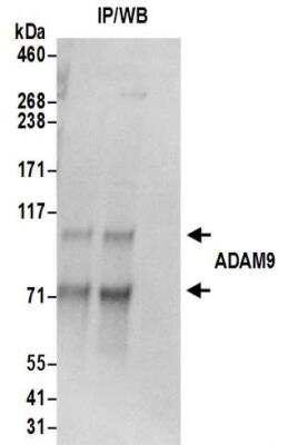Immunoprecipitation: ADAM9 Antibody [NBP2-32260]