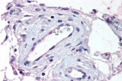 Immunohistochemistry-Paraffin: ADAMTS1 Antibody - BSA Free [NBP1-02338]