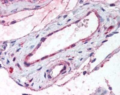 Immunohistochemistry-Paraffin: ADAMTS1 Antibody - BSA Free [NBP1-50161]