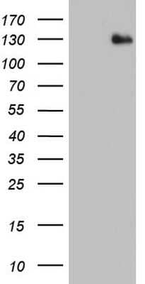 Western Blot: ADAMTS1 Antibody (OTI4H2) [NBP2-46492]