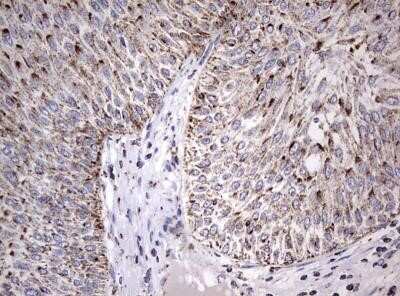Immunohistochemistry: ADAMTS1 Antibody (OTI4H2) - Azide and BSA Free [NBP2-71474]