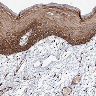 Immunohistochemistry-Paraffin: ADAMTS10 Antibody [NBP1-89248]