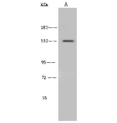 Western Blot: ADAMTS10 Antibody [NBP2-99535]