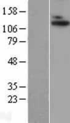 Western Blot: ADAMTS10 Overexpression Lysate [NBL1-07315]