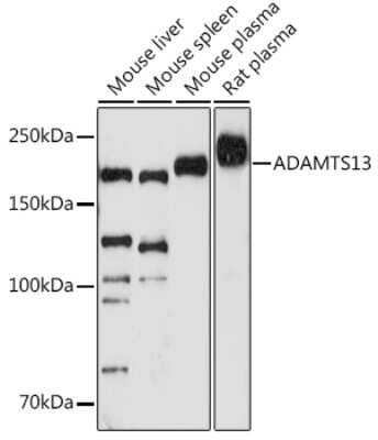 Western Blot: ADAMTS13 Antibody (7B2Z8) [NBP3-16038]