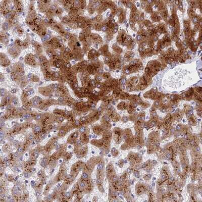 Immunohistochemistry-Paraffin: ADAMTS13 Antibody [NBP2-14265]