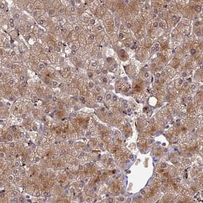 Immunohistochemistry-Paraffin: ADAMTS13 Antibody [NBP2-14266]