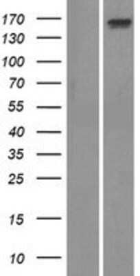 Western Blot: ADAMTS13 Overexpression Lysate [NBP2-05570]