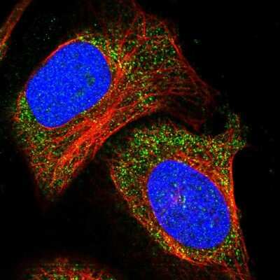 Immunocytochemistry/ Immunofluorescence: ADAMTS15 Antibody [NBP1-86209]