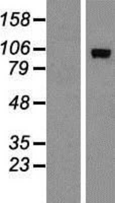 Western Blot: ADAMTS15 Overexpression Lysate [NBP2-05604]