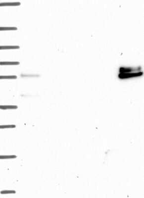 Western Blot: ADAMTS16 Antibody [NBP3-17147]