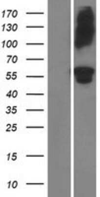 Western Blot: ADAMTS16 Overexpression Lysate [NBP2-05605]