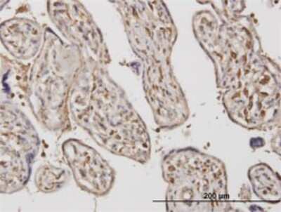 Immunohistochemistry-Paraffin: ADAMTS17 Antibody (3B7) [H00170691-M01]
