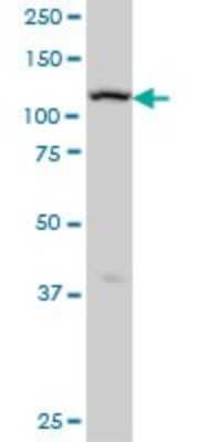 Western Blot: ADAMTS17 Antibody (3B7) [H00170691-M01]