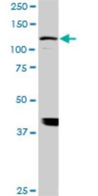 Western Blot: ADAMTS17 Antibody (3B7) [H00170691-M01]