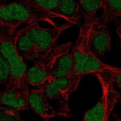 Immunocytochemistry/ Immunofluorescence: ADAMTS17 Antibody [NBP2-56304]