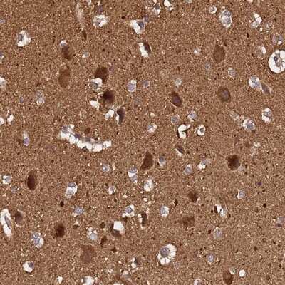 Immunohistochemistry-Paraffin: ADAMTS18 Antibody [NBP1-91651]