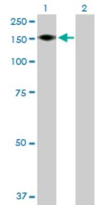 Western Blot: ADAMTS18 Antibody [H00170692-B01P]