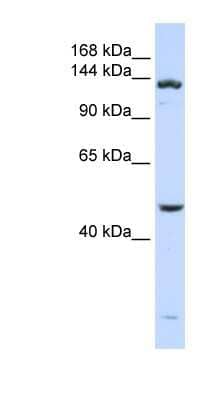 Western Blot: ADAMTS18 Antibody [NBP1-57095]