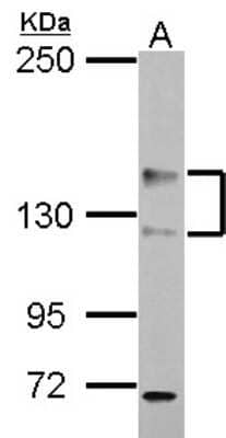 Western Blot: ADAMTS18 Antibody [NBP2-15285]