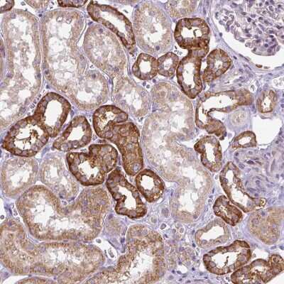 Immunohistochemistry: ADAMTS19 Antibody [NBP2-31627]