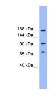 Western Blot: ADAMTS19 Antibody [NBP1-69170]