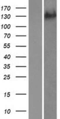 Western Blot: ADAMTS19 Overexpression Lysate [NBP2-05694]