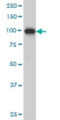 Western Blot: ADAMTS2 Antibody (7G3) [H00009509-M03]