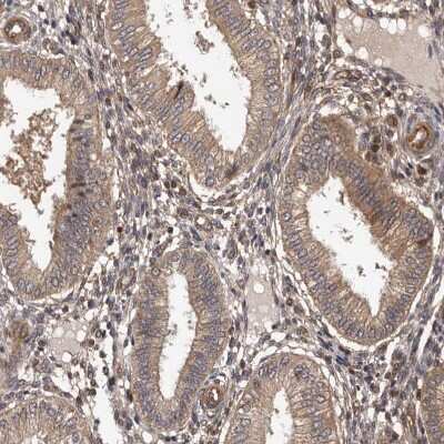 Immunohistochemistry-Paraffin: ADAMTS2 Antibody [NBP1-89246]