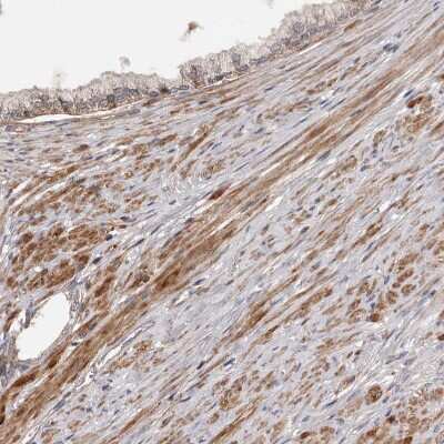 Immunohistochemistry-Paraffin: ADAMTS2 Antibody [NBP1-89246]