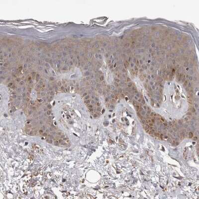 Immunohistochemistry-Paraffin: ADAMTS2 Antibody [NBP1-89246]