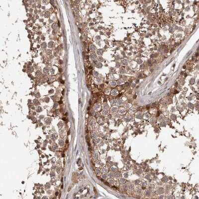 Immunohistochemistry-Paraffin: ADAMTS2 Antibody [NBP1-89246]