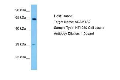 Western Blot: ADAMTS2 Antibody [NBP2-84393]