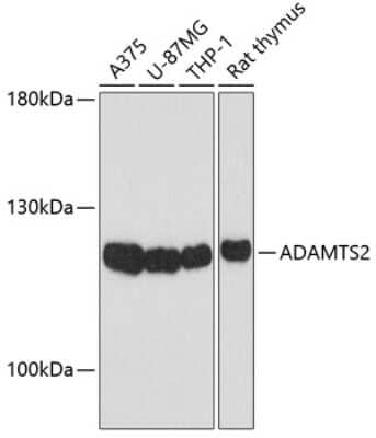 Western Blot: ADAMTS2 AntibodyBSA Free [NBP2-92008]