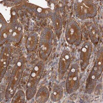 Immunohistochemistry-Paraffin: ADAMTS20 Antibody [NBP1-81807]