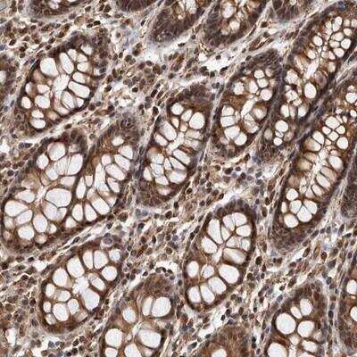 Immunohistochemistry-Paraffin: ADAMTS20 Antibody [NBP1-81808]