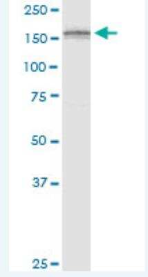 Western Blot: ADAMTS3 Antibody (1H8) [H00009508-M10-100ug]