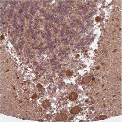 Immunohistochemistry-Paraffin: ADAMTS3 Antibody [NBP2-30495]