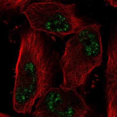 Immunocytochemistry/ Immunofluorescence: ADAMTS4 Antibody [NBP2-56239]