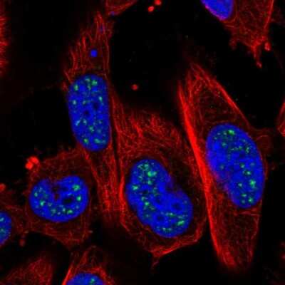 Immunocytochemistry/ Immunofluorescence: ADAMTS4 Antibody [NBP2-57839]