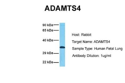 Western Blot: ADAMTS4 Antibody [NBP1-54369]