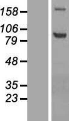 Western Blot: ADAMTS4 Overexpression Lysate [NBP2-07792]