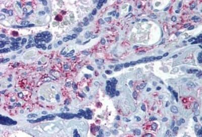 Immunohistochemistry-Paraffin: ADAMTS5 Antibody [NBP3-14533]