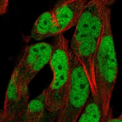 Immunocytochemistry/ Immunofluorescence: ADAMTS5 Antibody [NBP2-55653]