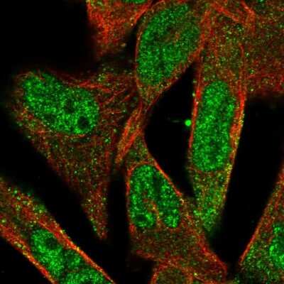 Immunocytochemistry/ Immunofluorescence: ADAMTS5 Antibody [NBP2-55654]