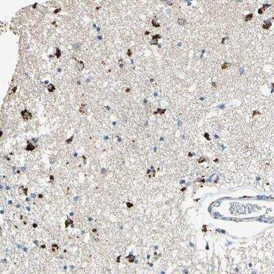 Immunohistochemistry: ADAMTS5 Antibody [NBP1-89247]