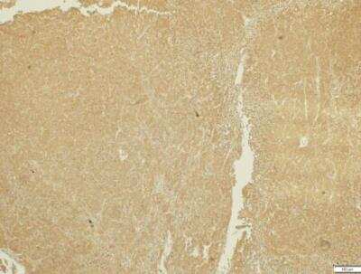 Immunohistochemistry-Paraffin: ADAMTS5 Antibody [NBP2-15286]