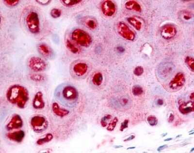 Immunohistochemistry-Paraffin: ADAMTS5 Antibody - BSA Free [NLS7761]
