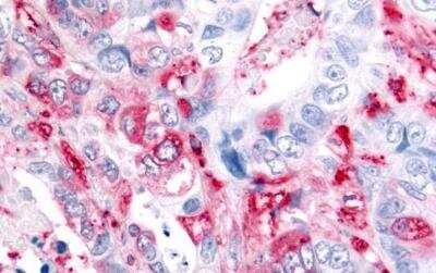 Immunohistochemistry-Paraffin: ADAMTS5 Antibody - BSA Free [NLS7761]